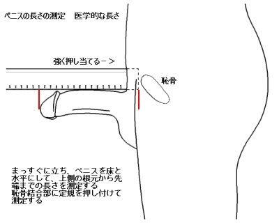 短小包茎とは！短小は何センチから？日本人の平均サイズや治療法 - アトムクリニック