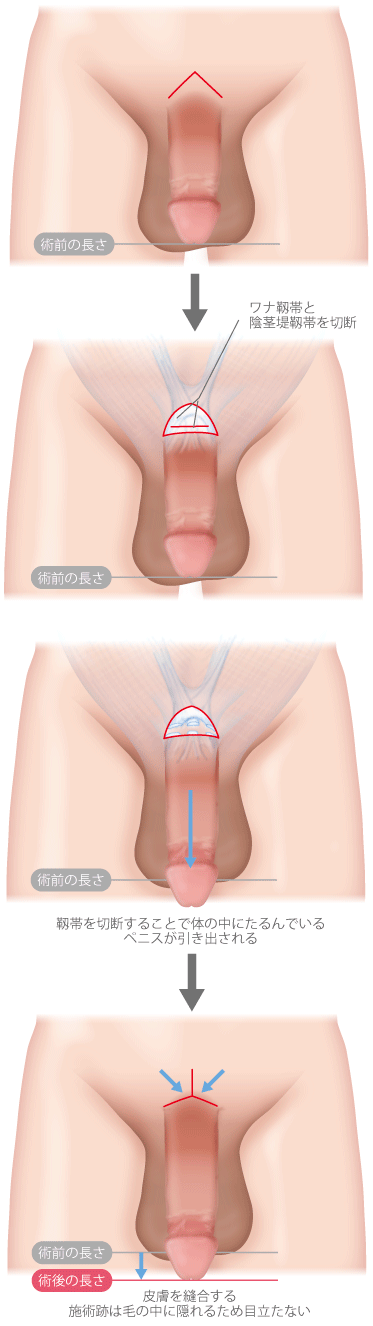 ペニスサイズデータ