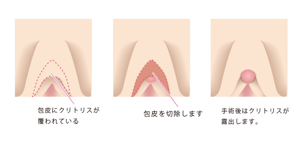 女性が中イキしやすくなる方法やコツからできない原因まで解説 | コラム一覧｜