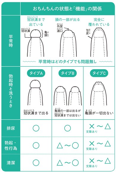 包茎、嵌頓包茎:どんな状態？何か悪いことはあるの？治療とその費用は？ – 株式会社プレシジョン