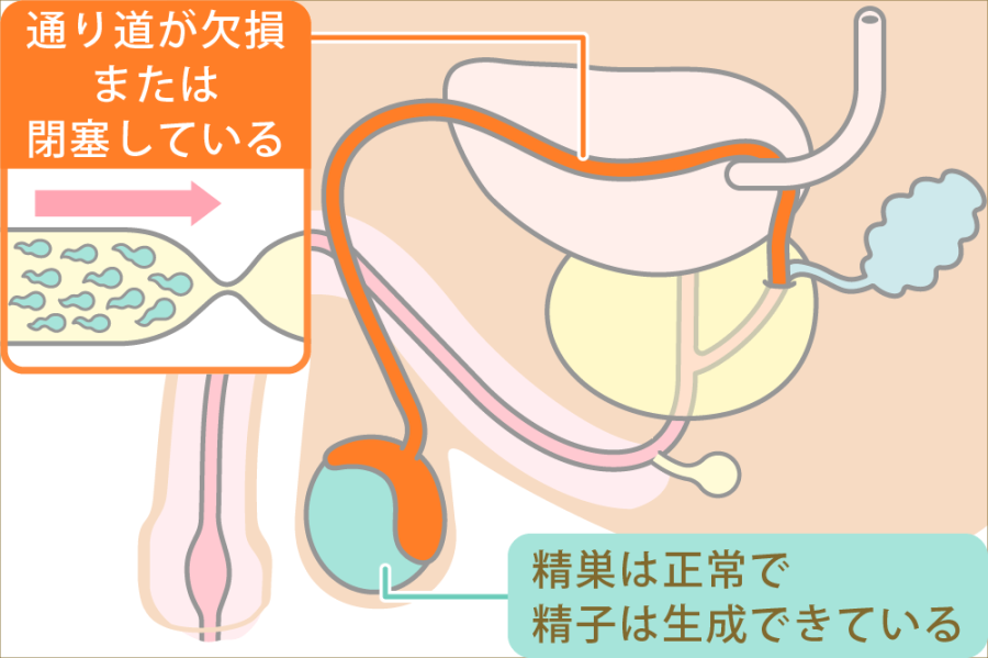 大きいことはいいこと？【しもじもの話】｜【西日本新聞me】