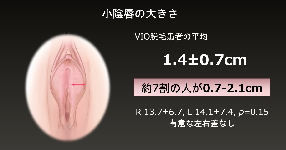 名器と呼ばれるまんこ10種類を解説！神まんこの特徴と名器を持つAV女優も紹介 │ スケベイト