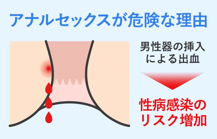 アナル内の洗浄のやり方とオススメの浣腸器 » アネロス・ネクサスレボを使って、自分の力でドライオーガズムを習得したい人の情報サイト