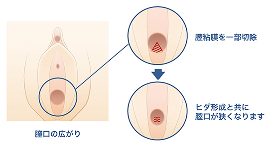 Amazon.co.jp: サニタリー用品 ペアラボ 天然海綿