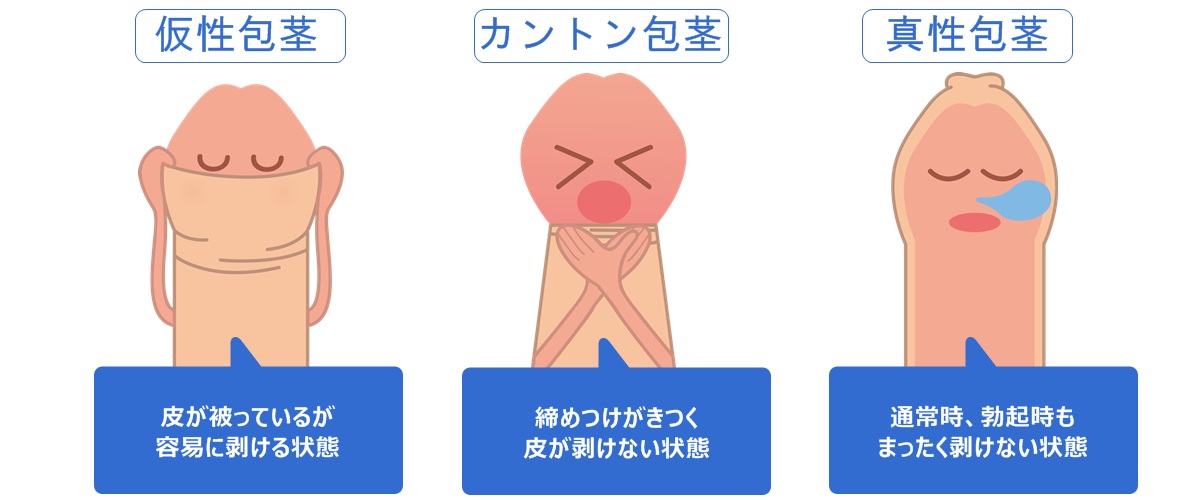 マジメに考える「男性器の誤解」～萎縮は思い込みだった！ 男性器は大きい