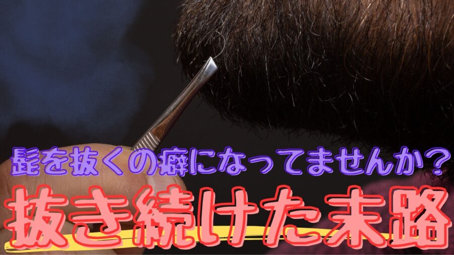 ヒゲを抜く やり方】ヒゲを10年抜いてきた実体験から注意点や効率良く抜くコツを解説｜ヒゲシェア