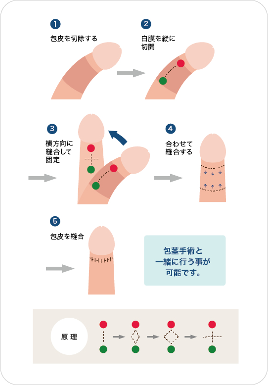 上反りちんこが女性を中イキさせる理由を画像でわかりやすく解説｜裏垢男子で年収2000万