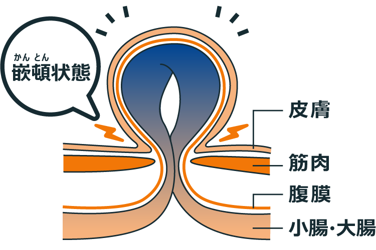 股関節痛 – 立川No.1実績｜選ばれる整体・鍼灸院｜15年以上の信頼と実績