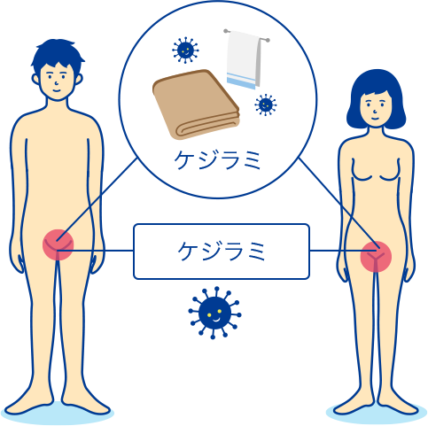 ツルツル派？残し派？今ドキVIOゾーンのムダ毛事情と正しいVIO処理とは。 | UP LIFE |