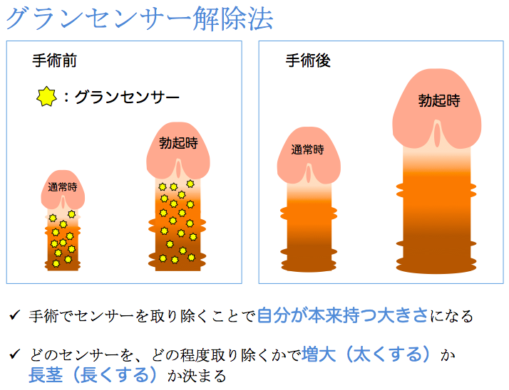 日本人の平均ペニスサイズ（通常時と勃起時）は○○cm！ – メンズ形成外科