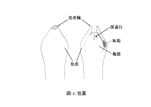 包茎とは・包茎の種類・包茎は病気なの？ – メンズ形成外科 | 青山セレス&船橋中央クリニック