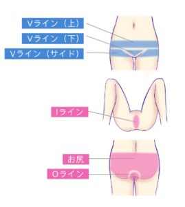 パイパンによって得られるメリットは多い？ | 岡山中央クリニック