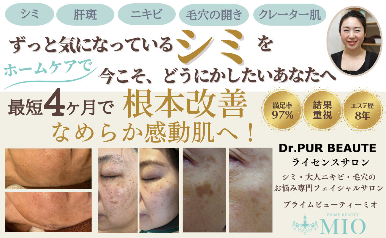 静岡市 シミ・大人ニキビ・毛穴の開きの根本改善・結果重視フェイシャルエステサロン【PRIME BEAUTY MIO】