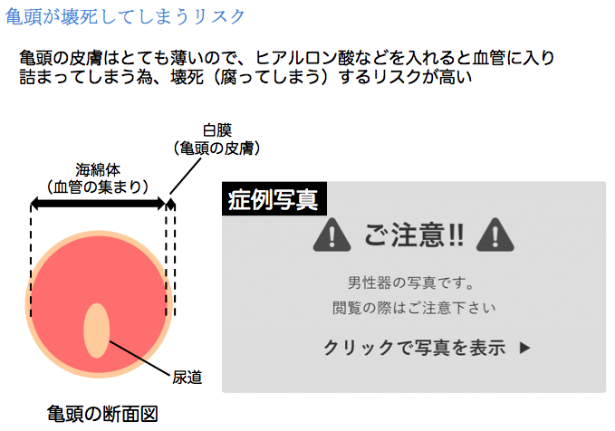 ペニスを大きくする理論的な「チントレ」方法【図解・動画】 | セクテクサイト