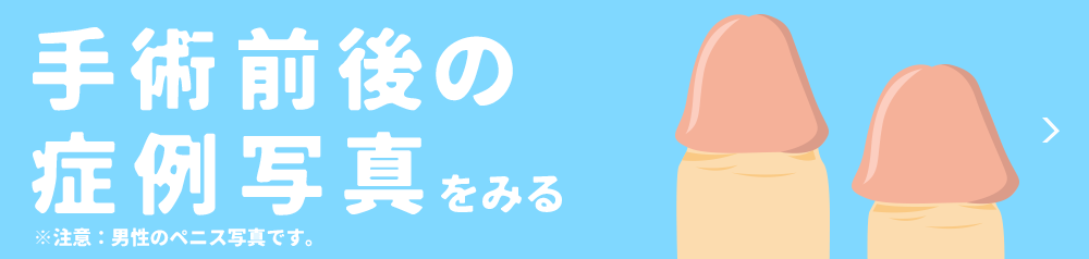 陰茎（ペニス）が小さくなる原因と対策を解説【医師監修】 | 新橋ファーストクリニック【公式】