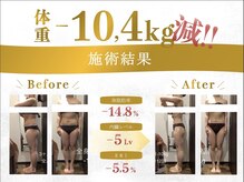 大阪 枚方市 痩身エステダイエットサロン 癒されながら痩せるサロンBloom