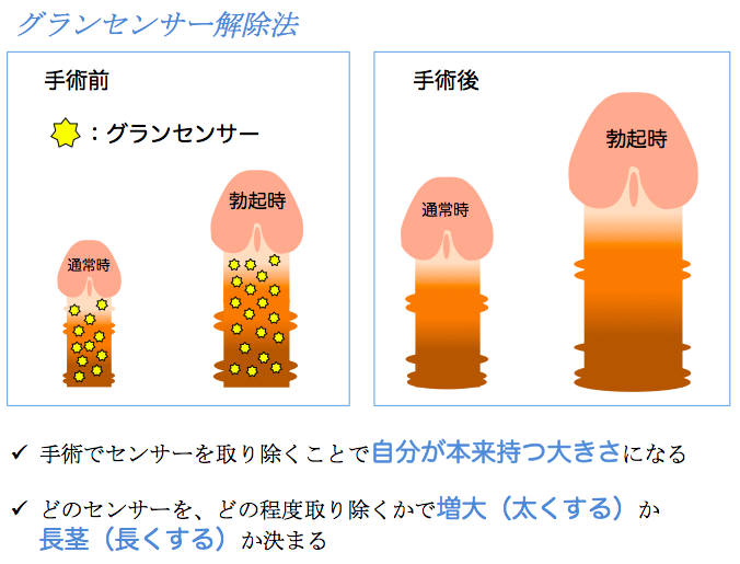 亀頭増大・陰茎増大・ペニスを大きく（太く）｜岡山中央クリニック（公式サイト）