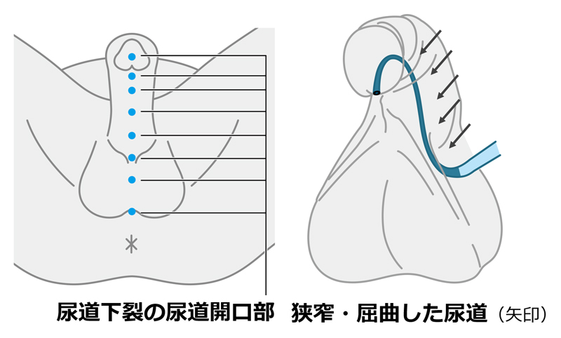 膀胱を虐められる男の子の話 | BL小説 |