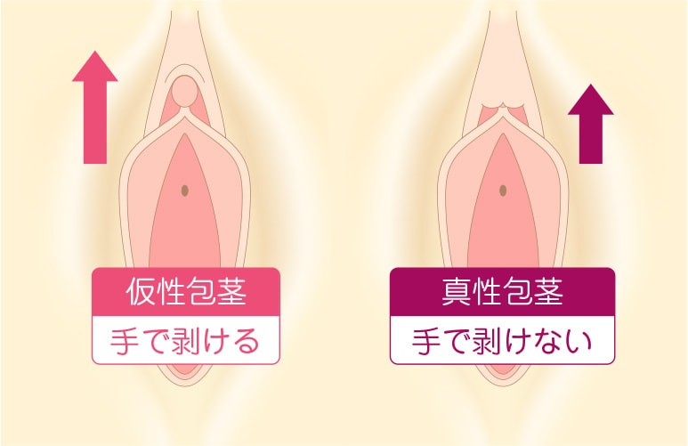 44歳で第3子出産の産後での女性器の構造・はたらき・特徴を徹底解説【産婦人科医監修】 -  臨床心理士・パーソナルトレーナーの小中学生復学支援・小学生・中学生家庭教育支援・ 不登校母親メンタルサポート