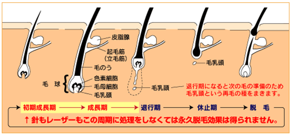 ヒゲ脱毛直後におきる泥棒ヒゲについて｜【公式】メンズリゼのヒゲ脱毛専門サイト