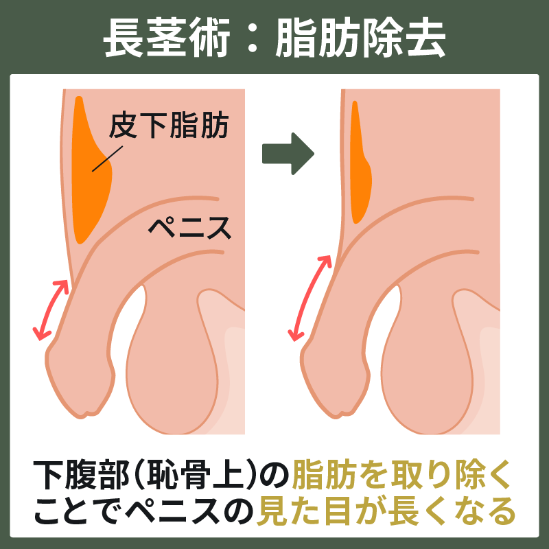 ペニスを大きくする理論的な「チントレ」方法【図解・動画】 | セクテクサイト