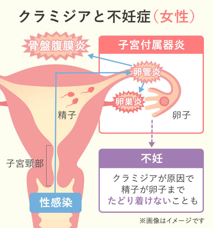 女性泌尿器外来（予約可能） | 名古屋東女性のクリニック