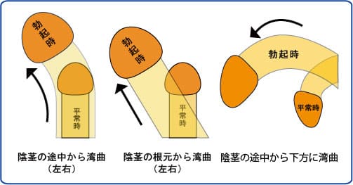 陰茎の大きさの基準は？ 大きく見せる方法も紹介