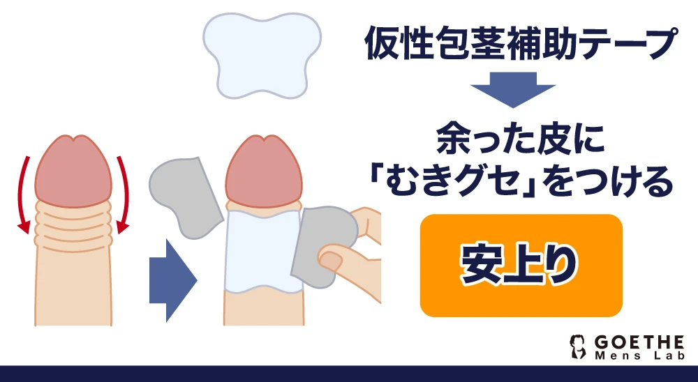 ドリチンとは？ドリチンのデメリットと最善の治療法を徹底解説 | 【フェアクリニック】包茎・薄毛・男の悩み相談所