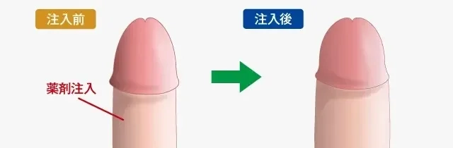 でかいちんこの基準とは？日本人平均や大きくする方法を解説 |【公式】ユナイテッドクリニック