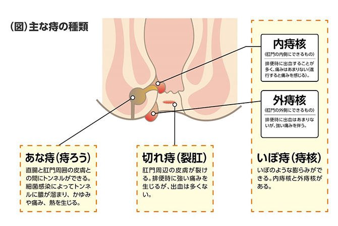 アナルセックス危険性 肛門にも性病感染する？|天神マイケアクリニック