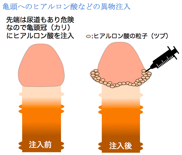 1分で分かる！シトルリンの摂取量目安やペニスへの効果！ペニス増大したい方必見の情報を紹介 | 健康コラム