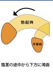 勃起の角度は何度が平均？低い原因や上向きにする方法を解説 |【公式】ユナイテッドクリニック