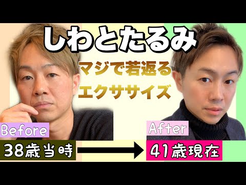 男性のブルドック顔の治療について｜プライベートスキンクリニック