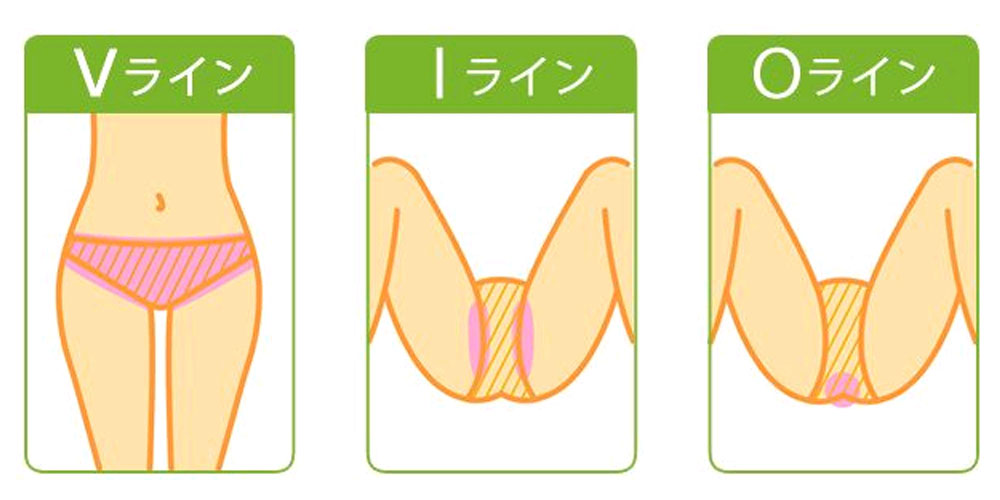 陰毛の処理と、処理後について。※お見苦しい写真を添付しておりますので、ご注意く - Yahoo!知恵袋