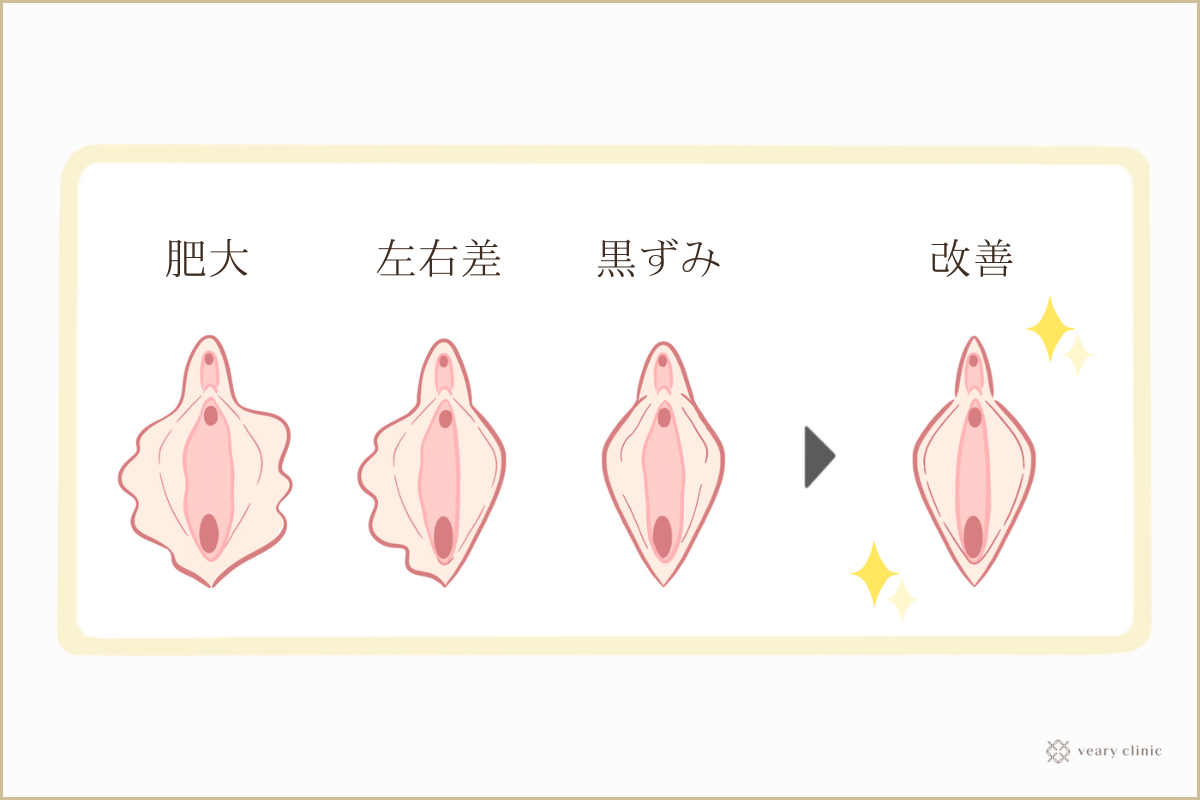 ちんこ内メーカー | .