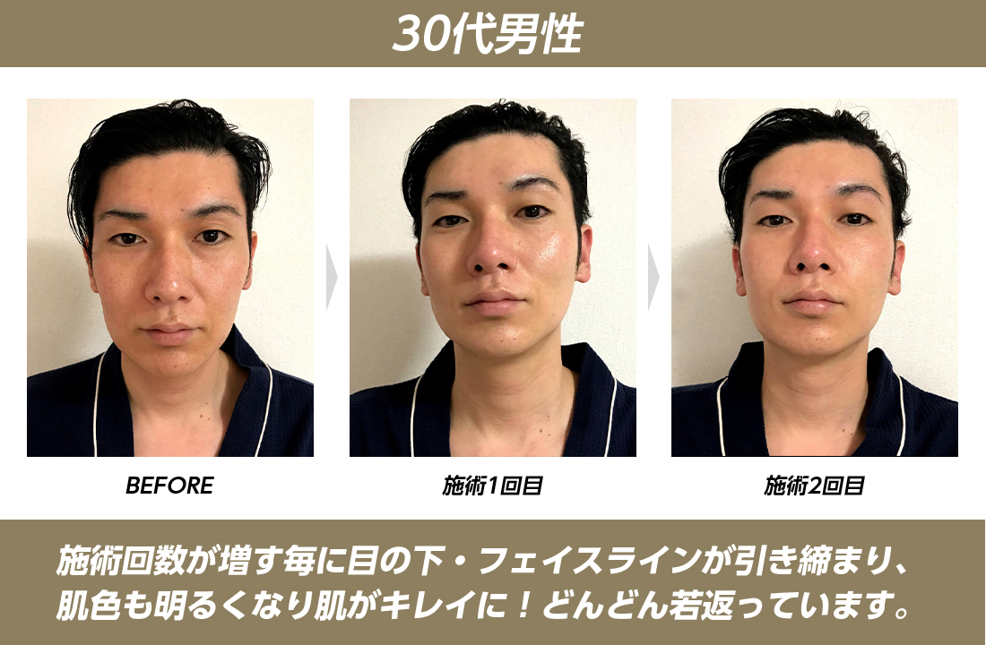 フェイシャルエステ 男性の写真素材｜写真素材なら「写真AC」無料（フリー）ダウンロードOK