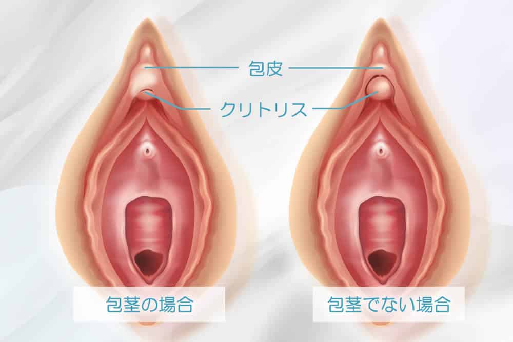 膣の乾燥度チェック】あなたの「デリケートゾーン」大丈夫？ | 美ST ONLINE