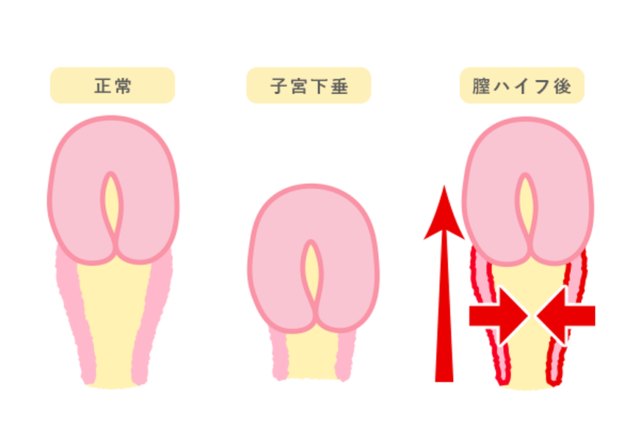 性別適合手術MTF｜性同一性障害（GID）の総合診療｜ナグモクリニック [ 東京・名古屋・大阪・福岡 ]