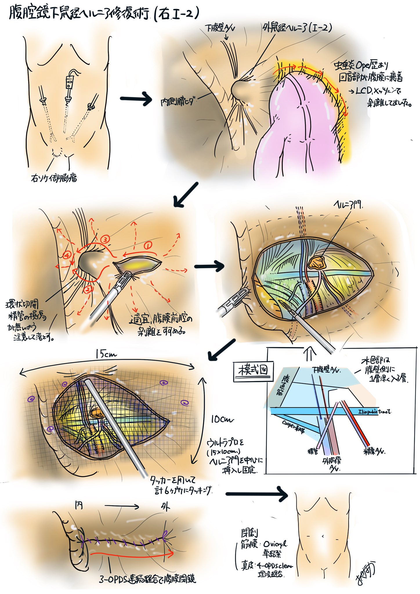 surgery2_2.png