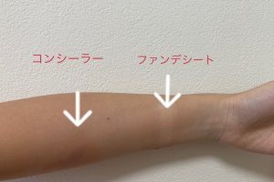 キスマークの消し方！すぐ即効で消す方法に隠し方を紹介！ | コタローの日常喫茶