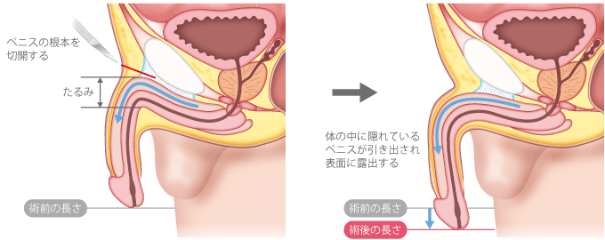 リンガムマッサージとは【精力回復の睾丸マッサージ】セブセレクトツアーズマガジン