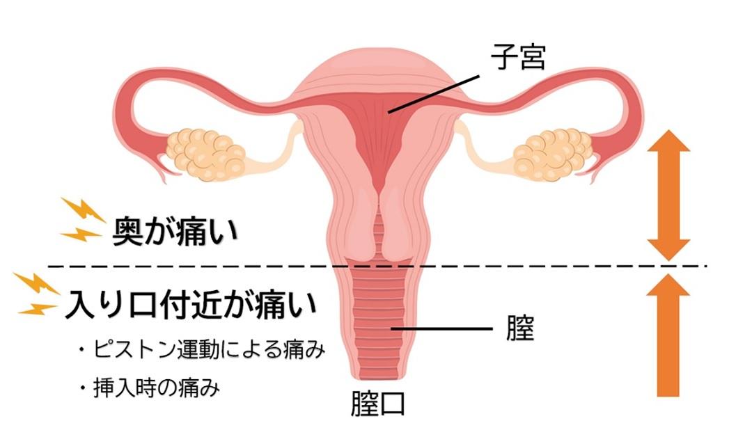 そのH、間違えてない…？「これが私たちの本音！男子がやりがちなダメH」 メンズノンノウェブ | MEN'S NON-NO