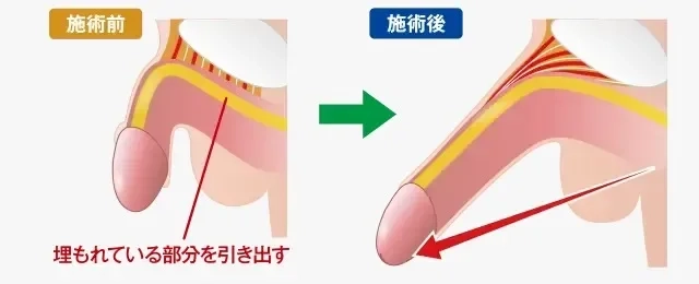 ペニスの大きさ平均は13cm！女性の理想サイズはさらにデカい！？｜薬の通販オンライン