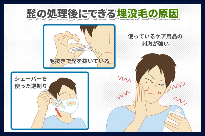 気にしすぎ？ 青髭の原因と対策・治し方や女性からの印象について解説します | アーバンライフ東京