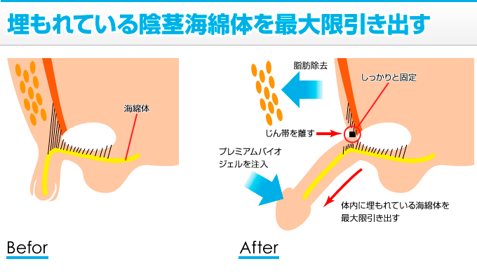 男性器の解剖学 :: 酒井形成外科 美容外科 メンズサイト