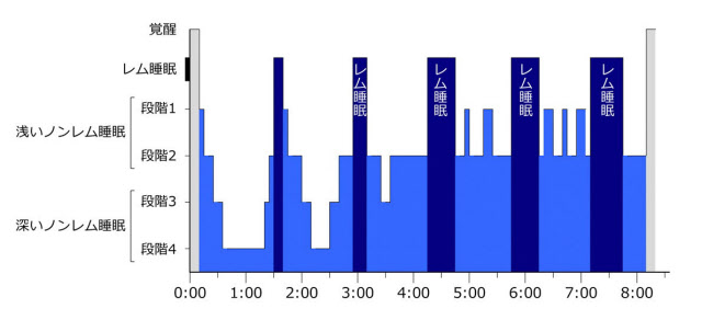 性欲と無関係に起こる持続勃起症緊急治療要することも（東邦大学医療センター大森病院リプロダクションセンター 永尾光一センター長）｜医療ニュース  トピックス｜時事メディカル｜時事通信の医療ニュースサイト