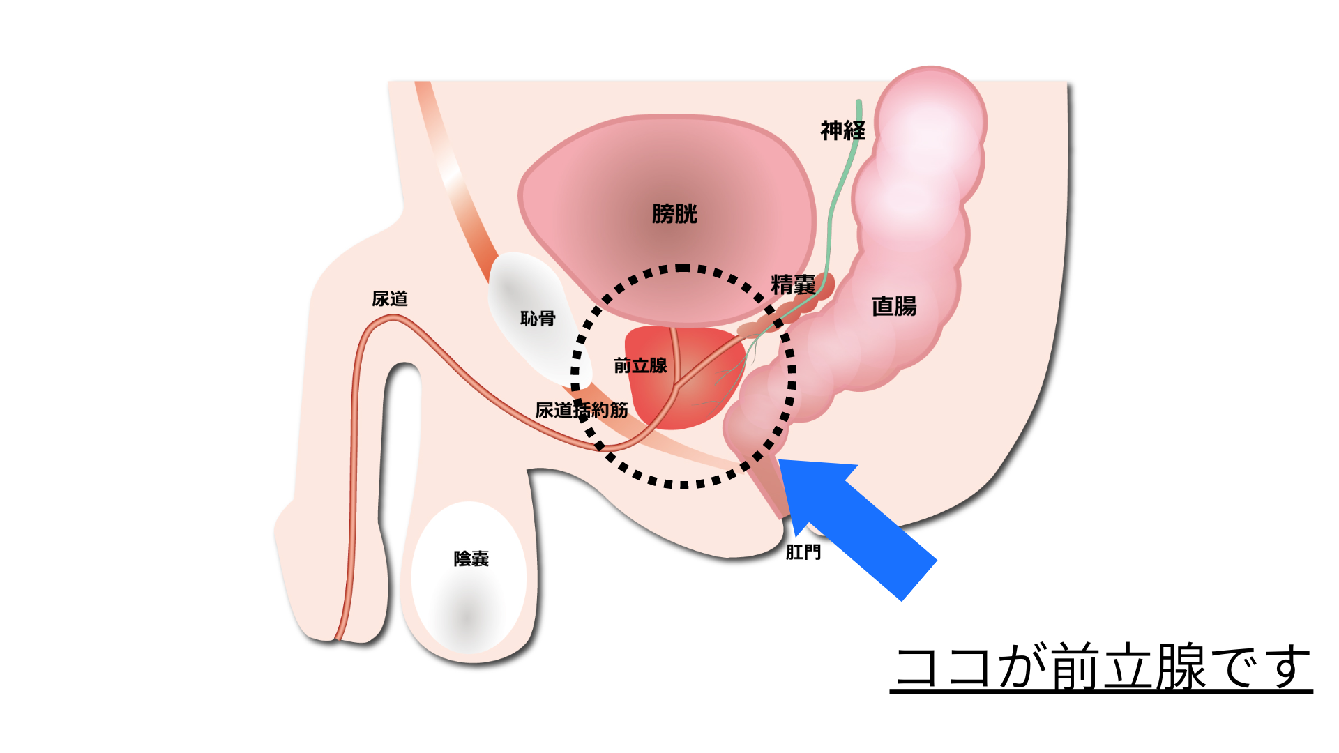 屈曲ペニス・湾曲ペニス修正手術-東郷美容形成外科 福岡メンズ｜福岡・博多で屈曲・湾曲ペニス・日本形成外科学会専門医が手術