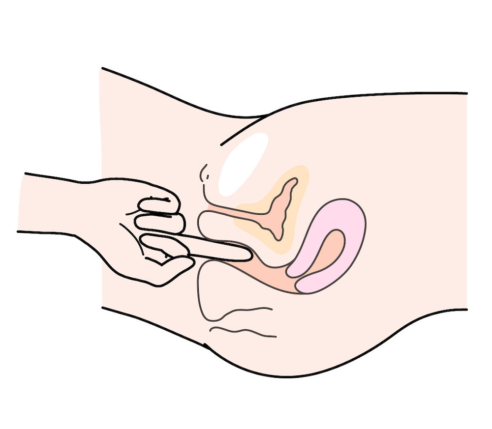 バルトリン腺嚢胞の原因・症状と効果的な治療法を女医が丁寧に解説。 –  港区、品川区の産婦人科で妊婦健診・産後ケア・避妊相談なら│海老根ウィメンズクリニック