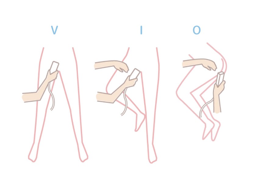 VIO脱毛後の排尿は注意！尿の飛び散りの傾向と対策 - トイトイトイクリニック