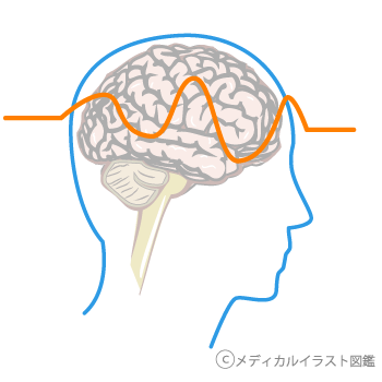 早めに気づいて！女性に多い病気と症状｜知っておきたい女性のカラダと健康のこと｜女性のための健康ラボ Mint⁺